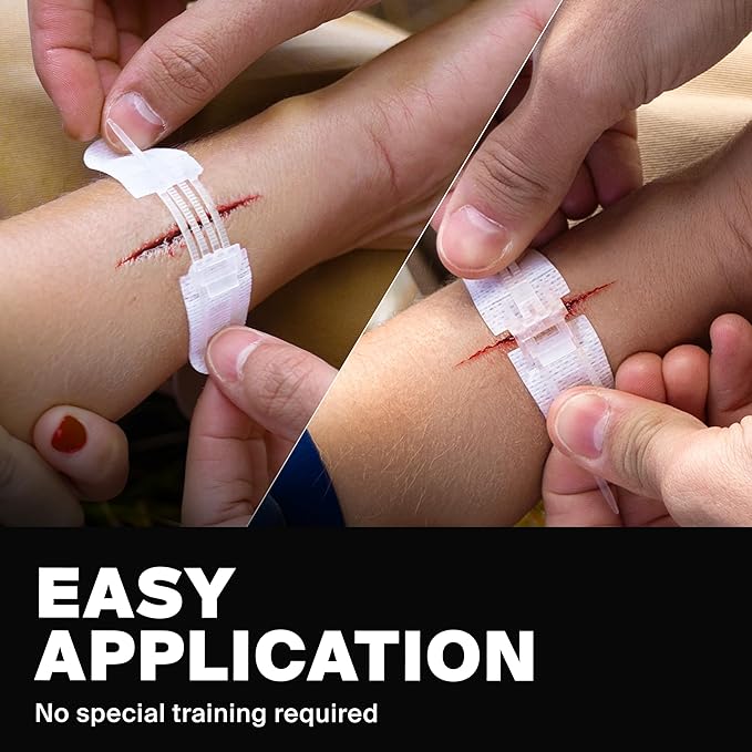 Zip-Stitchy: Wound Closure Kit
